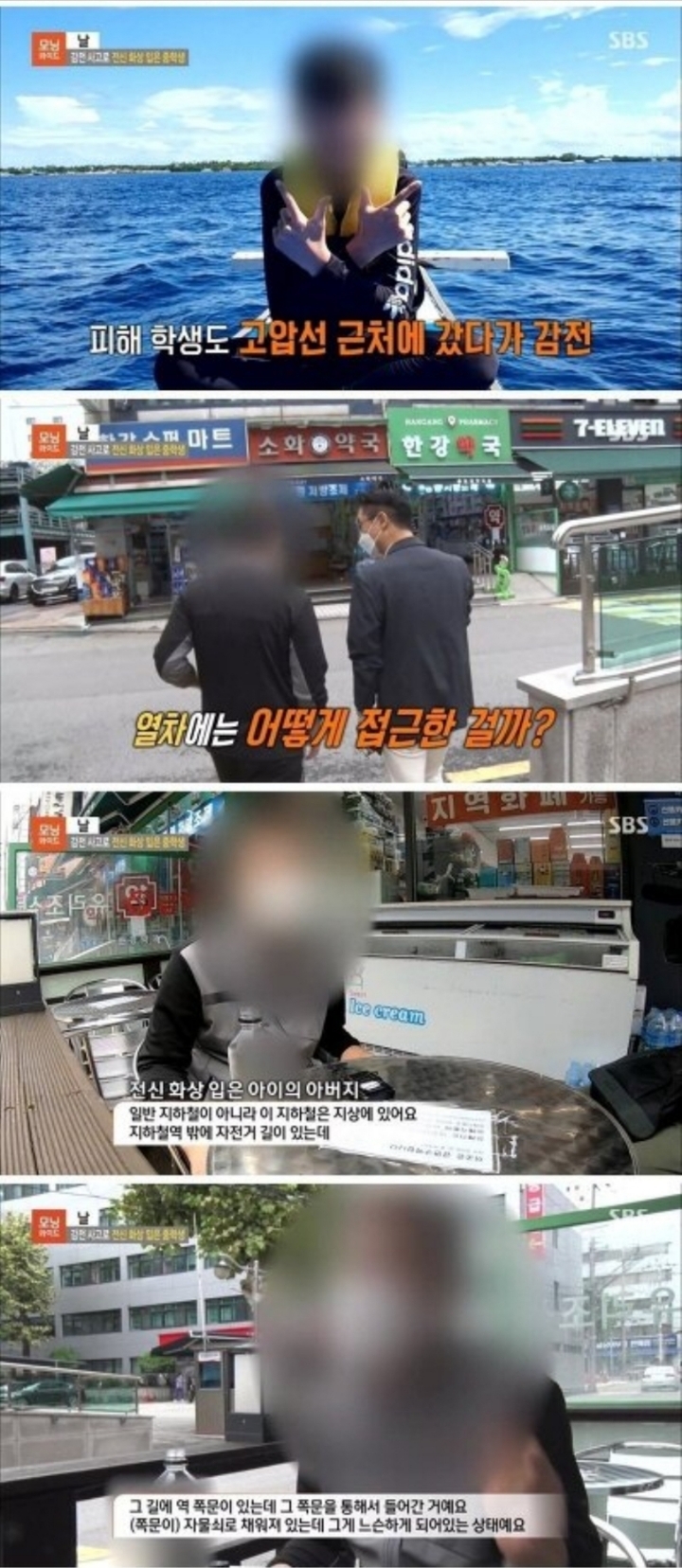 감전 사고로 전신 화상 입은 중학생.jpg | 인스티즈