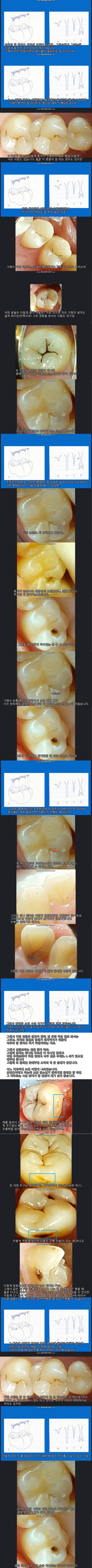 치아건강이 운빨좆망겜인이유 | 인스티즈