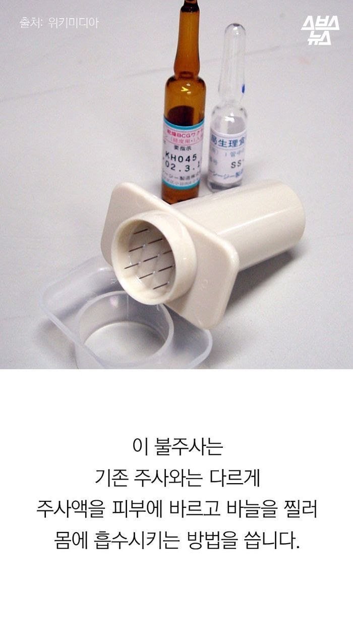 20대 초반 이하만 가지고 있다는 자국 (95년생~2000년생) | 인스티즈