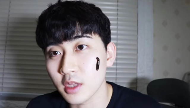 혐주의] 실제로 여드름에 효과적인라는 치료방법 | 인스티즈