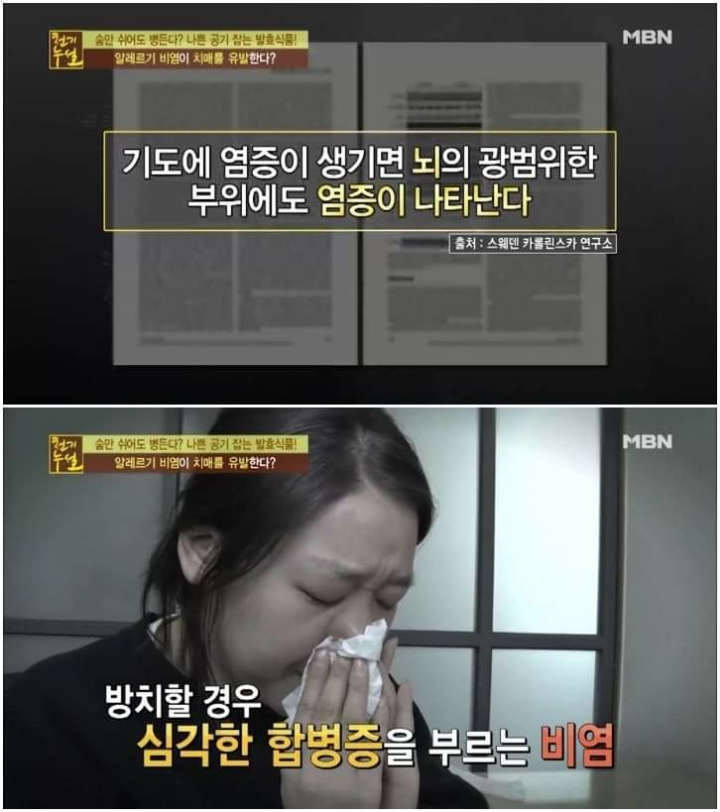 비염을 방치하면 안되는이유 | 인스티즈