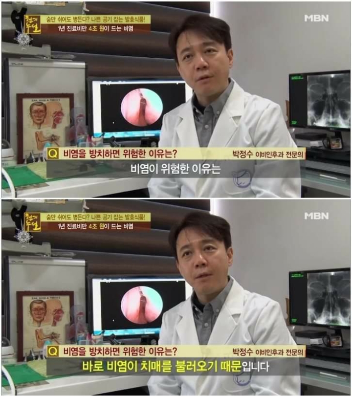 비염을 방치하면 안되는이유 | 인스티즈