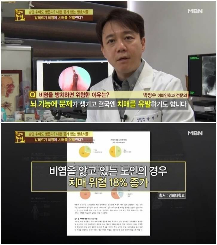 비염을 방치하면 안되는이유 | 인스티즈