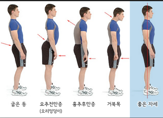 어렸을 때 관리 안 해서 제일 후회하는 것은?? | 인스티즈