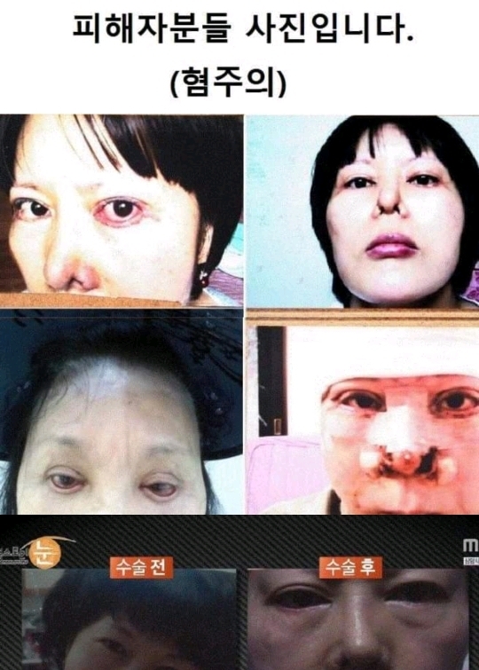 일부러 수술을 망치는 사이코패스 의사 | 인스티즈