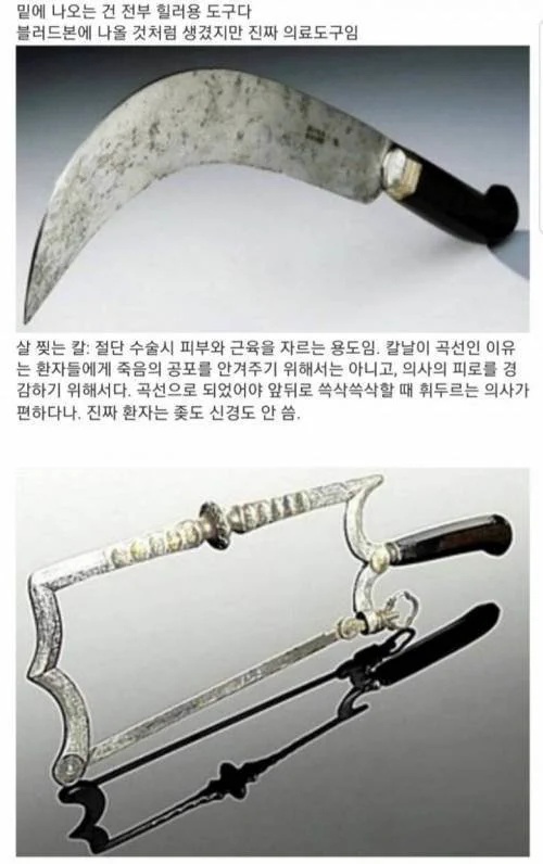 서양에서 한동안 외과의사 취급이 안좋았던 이유 | 인스티즈