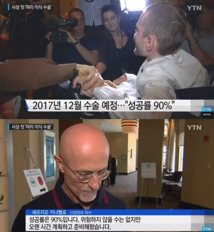 머리 이식 수술...jpg | 인스티즈