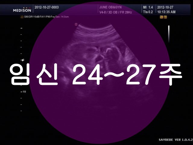 임신 24주~27주 : 입체초음파도 하고왔어요^^