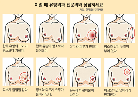 겨드랑이 혹, 멍울 규칙적인 유방암 자가진단법 소개