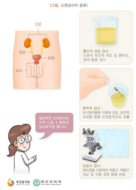 남자 잔뇨감 과민성방광 원인과 치료방법