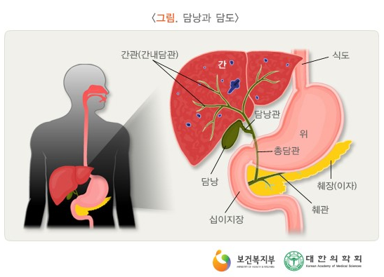 명치가 아픈이유 정확한 원인 정리