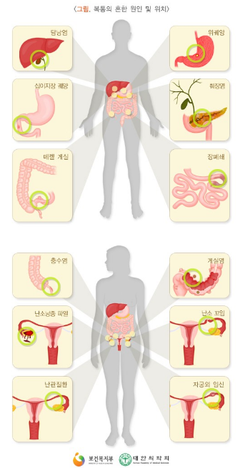 윗배가 아플때, 복통의 원인 5가지