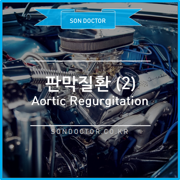 [MC] 판막질환 (2) Aortic Regurgitation
