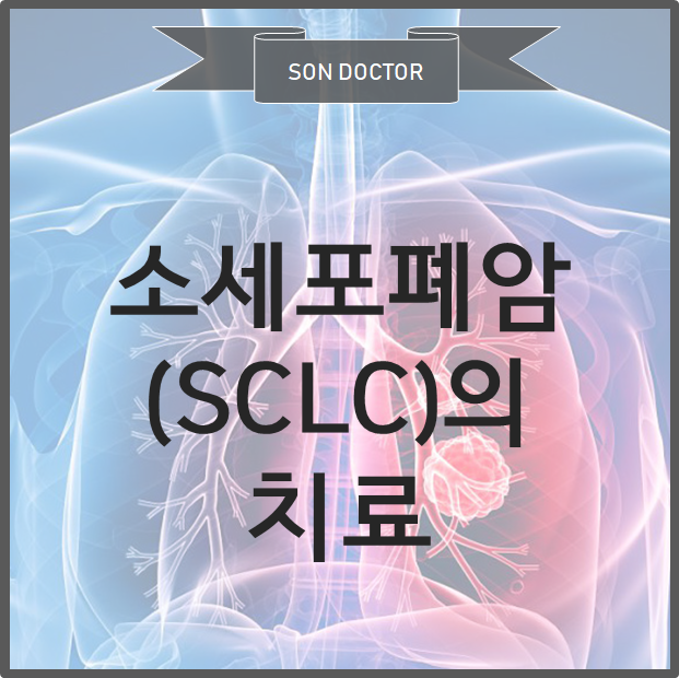 소세포 폐암 (SCLC) 의 치료