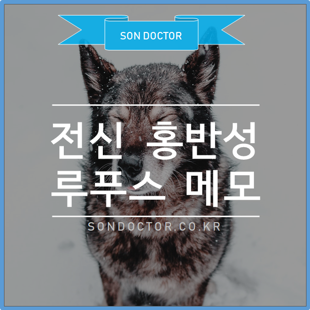 전신 홍반성 루푸스 메모