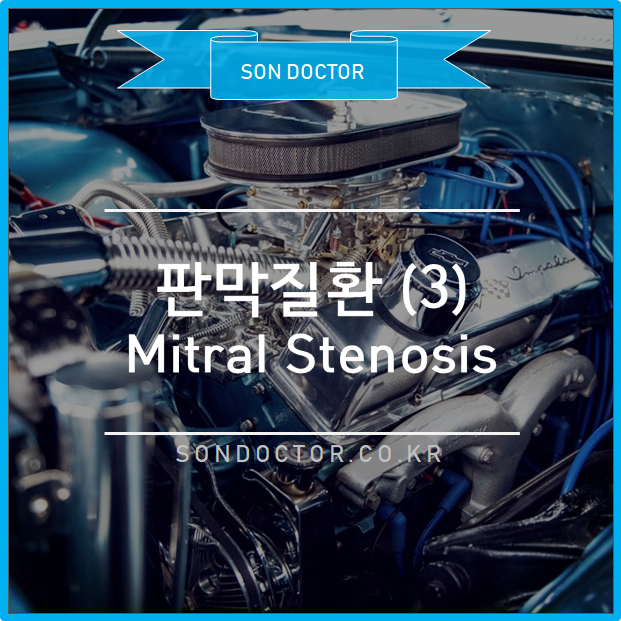 [MC] 판막질환 (3) Mitral stenosis