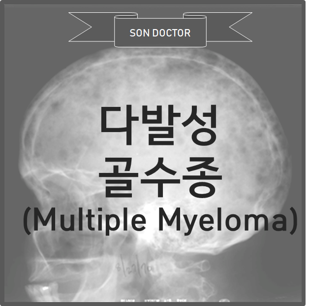 [MH] 다발성 골수종 (Multiple myeloma;MM)