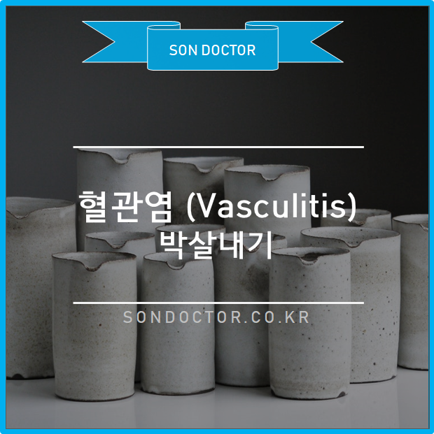 혈관염 (Vasculitis) 박살내기