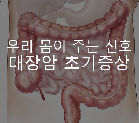 대장암 초기증상 | 우리몸이 주는 신호 다섯가지 알아보기