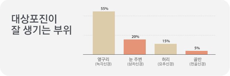 대상포진과 원인 증상 예방법을 알아보자