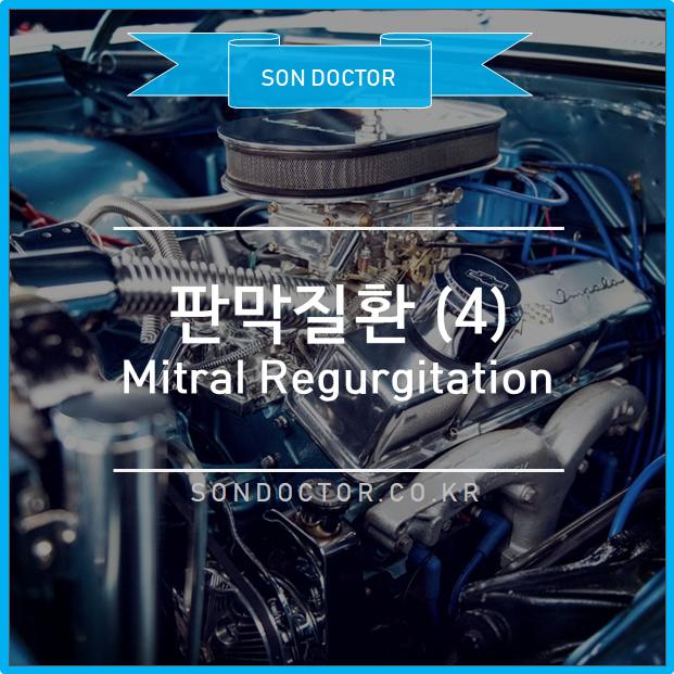 [MC] 판막질환 (4) Mitral Regurgitation