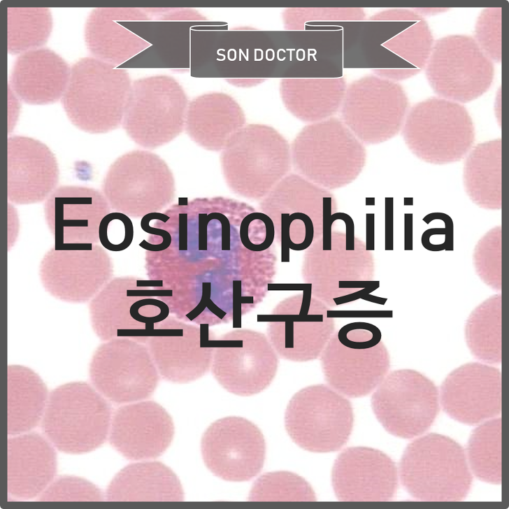 Eosinophilia (호산구증)