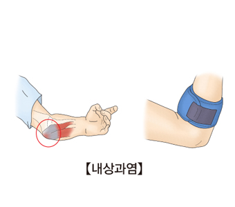 내로 이미지