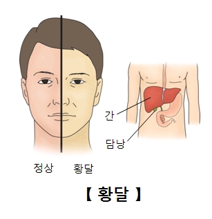 낭 이미지