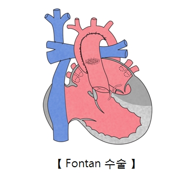온전 이미지
