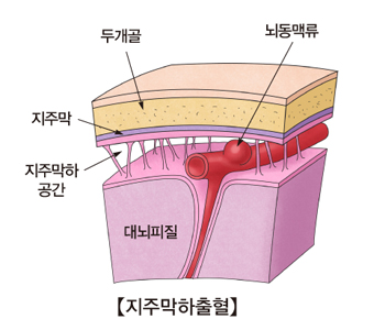 하이으나 이미지