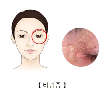 작은인 이미지