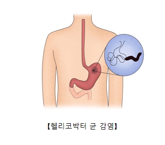 위 이미지