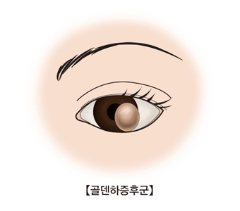 하이으나 이미지