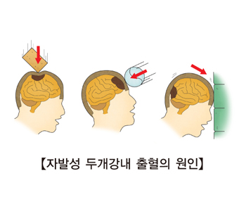 내로 이미지