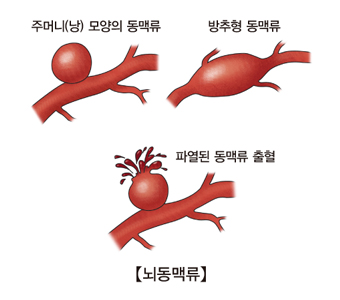 하이으나 이미지