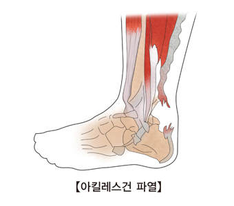 발로만 이미지