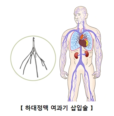 심 이미지