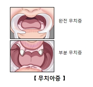 무와 이미지