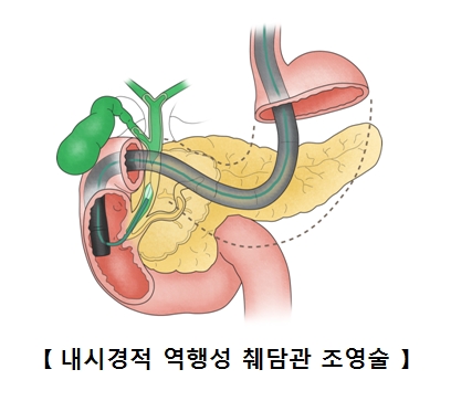 낭 이미지