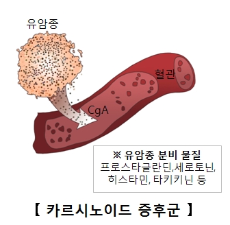 위 이미지