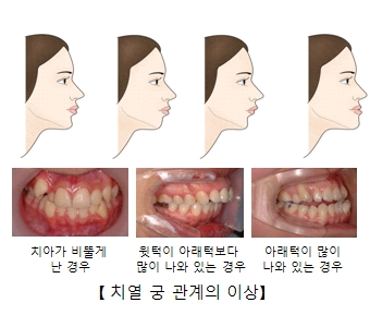 궁 이미지