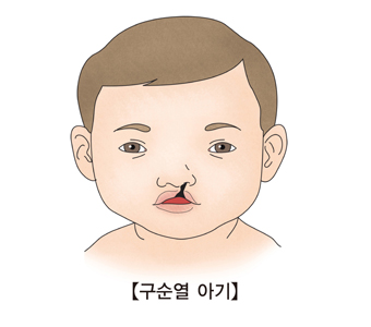 22 이미지
