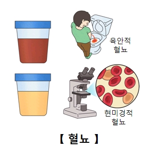 발로만 이미지