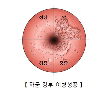 내로 이미지