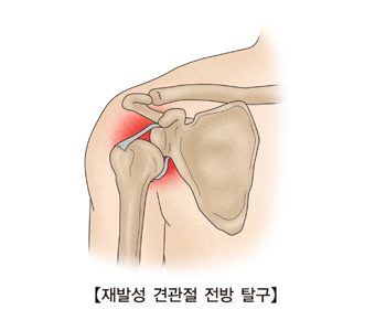 달라짐 이미지