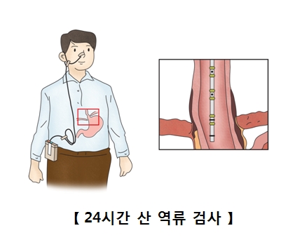 위 이미지
