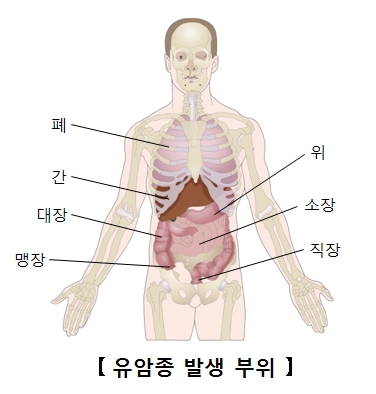 위 이미지
