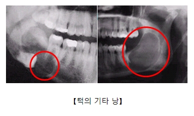낭 이미지
