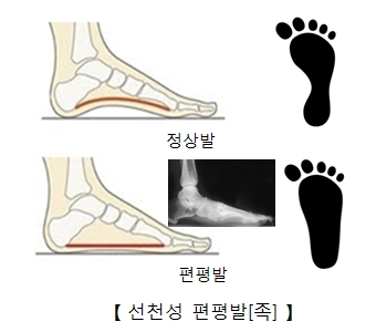 주로 이미지