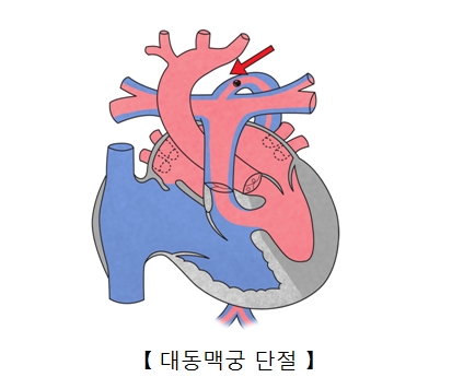 궁 이미지